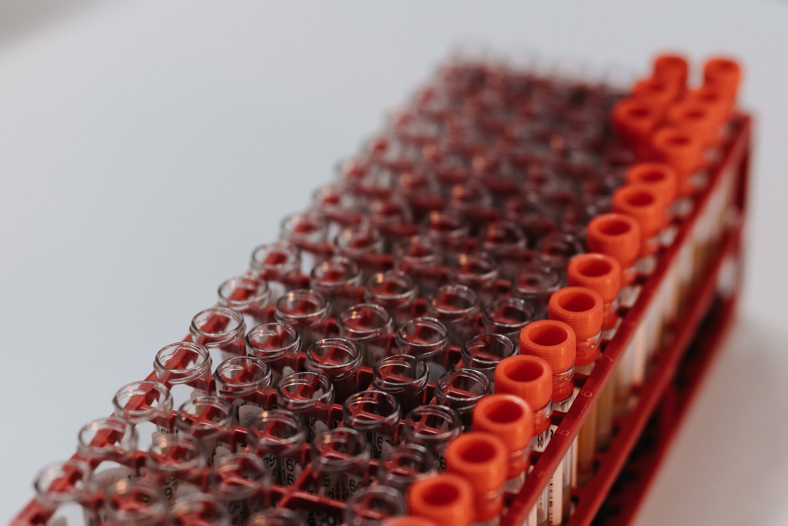Détail test tubes rack recherche laboratoire moderne
